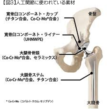 人工関節に使われている素材