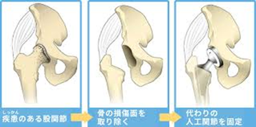 イメージ画像