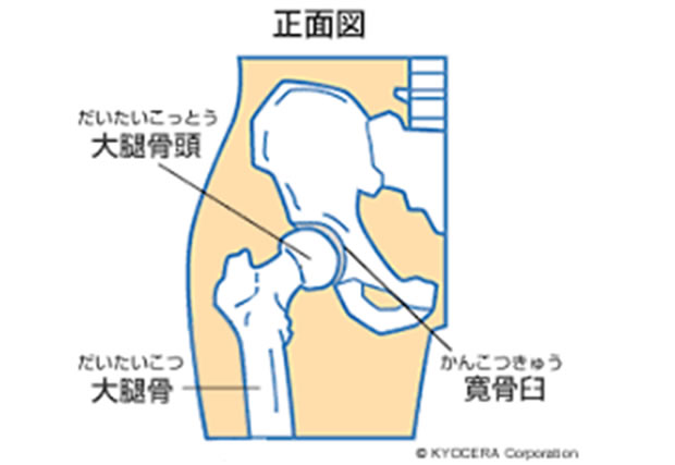 人工関節人工股関節の術後に肉体労働はできる？人工股関節手術後の仕事復帰について置換術の術後の生活と注意点