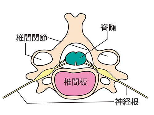 脊椎の主な疾患イメージ図