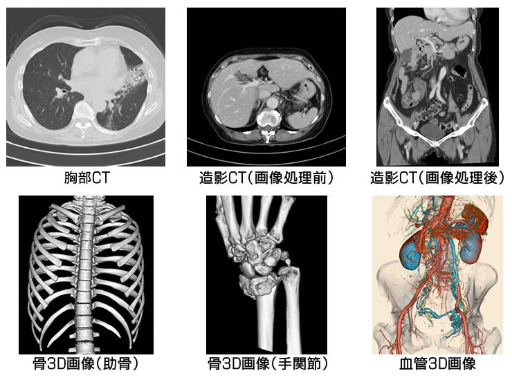 MRI撮影室[写真]