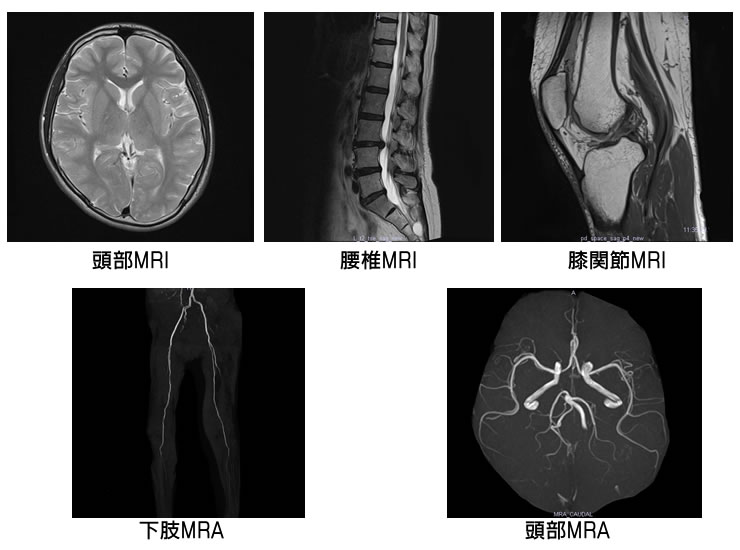 MRI撮影室[写真]